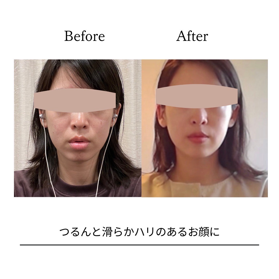 BeforeAfterPhoto