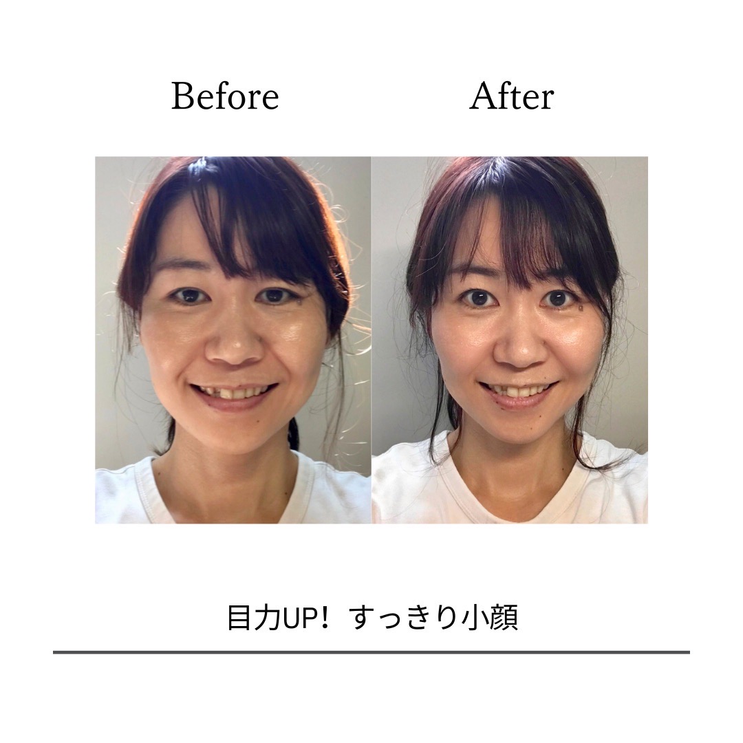 BeforeAfterPhoto