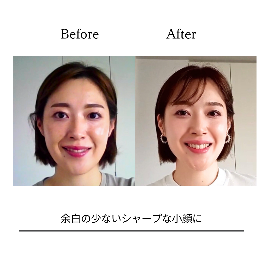 BeforeAfterPhoto