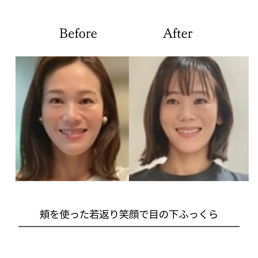 BeforeAfterPhoto