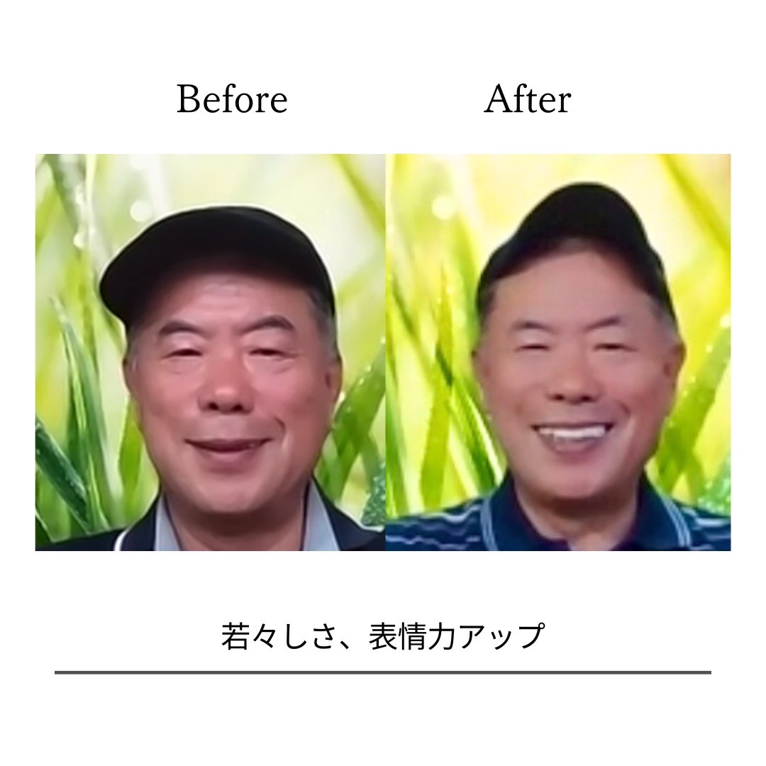 BeforeAfterPhoto