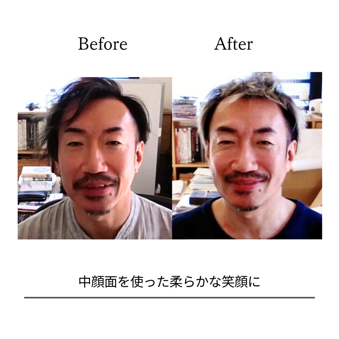 BeforeAfterPhoto