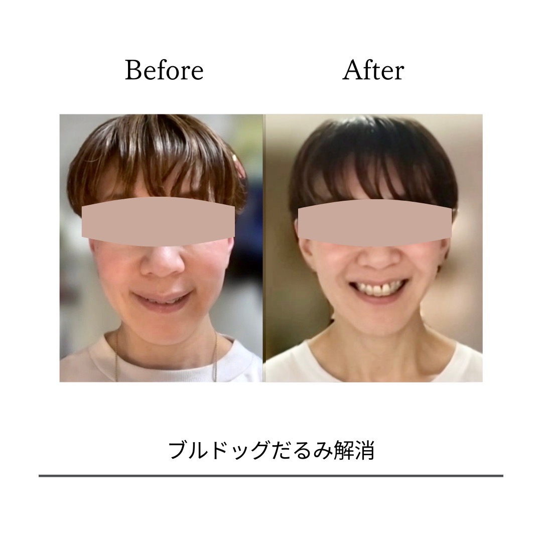 BeforeAfterPhoto