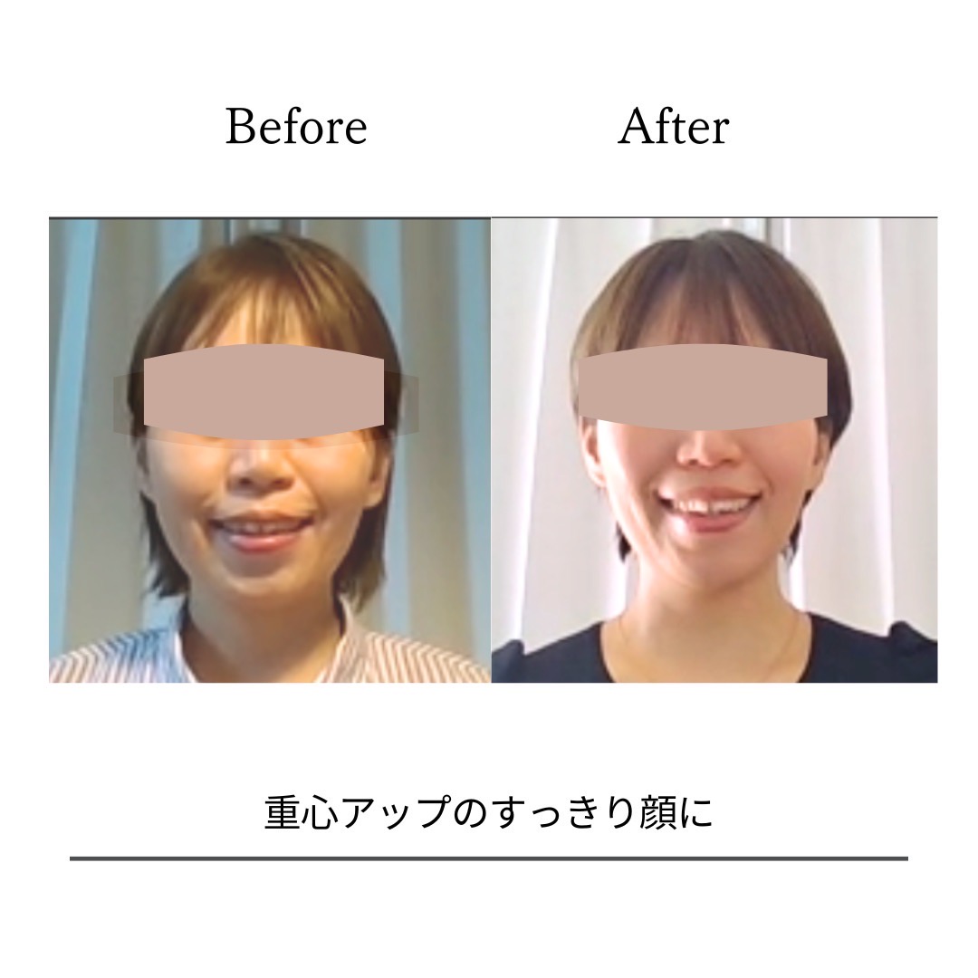 BeforeAfterPhoto