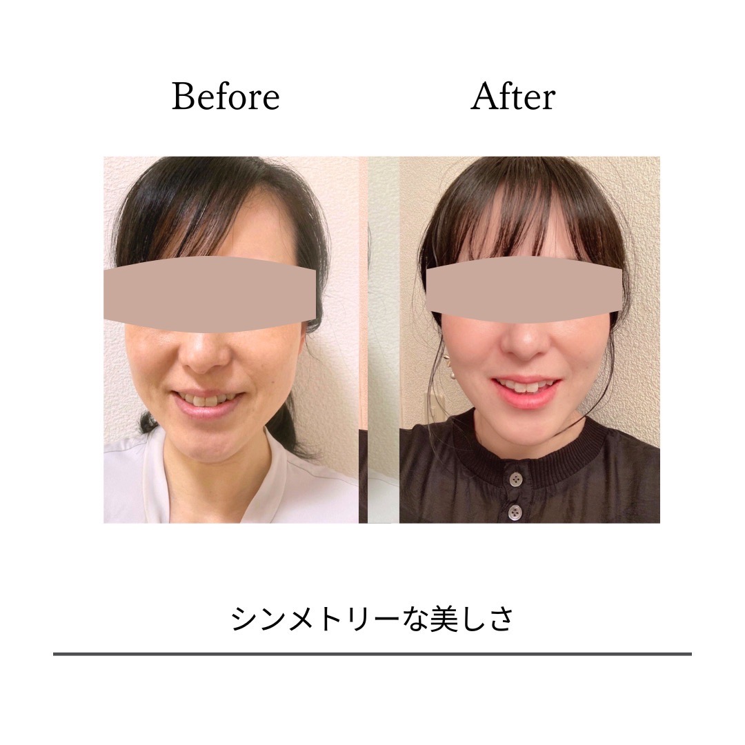 BeforeAfterPhoto